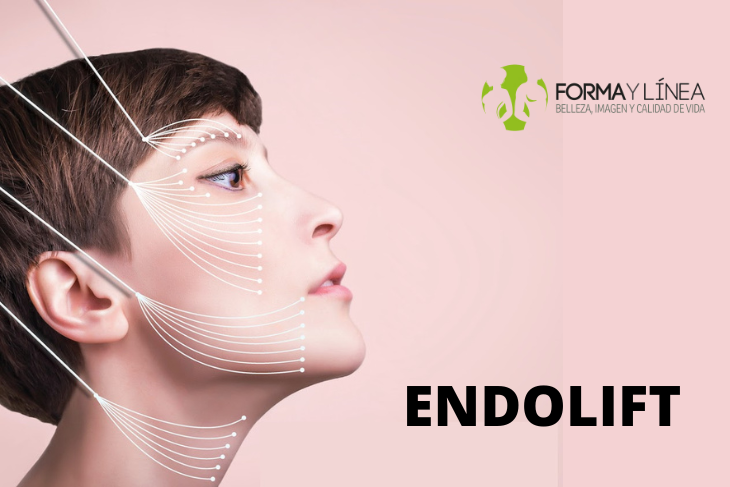 ENDOLIFT